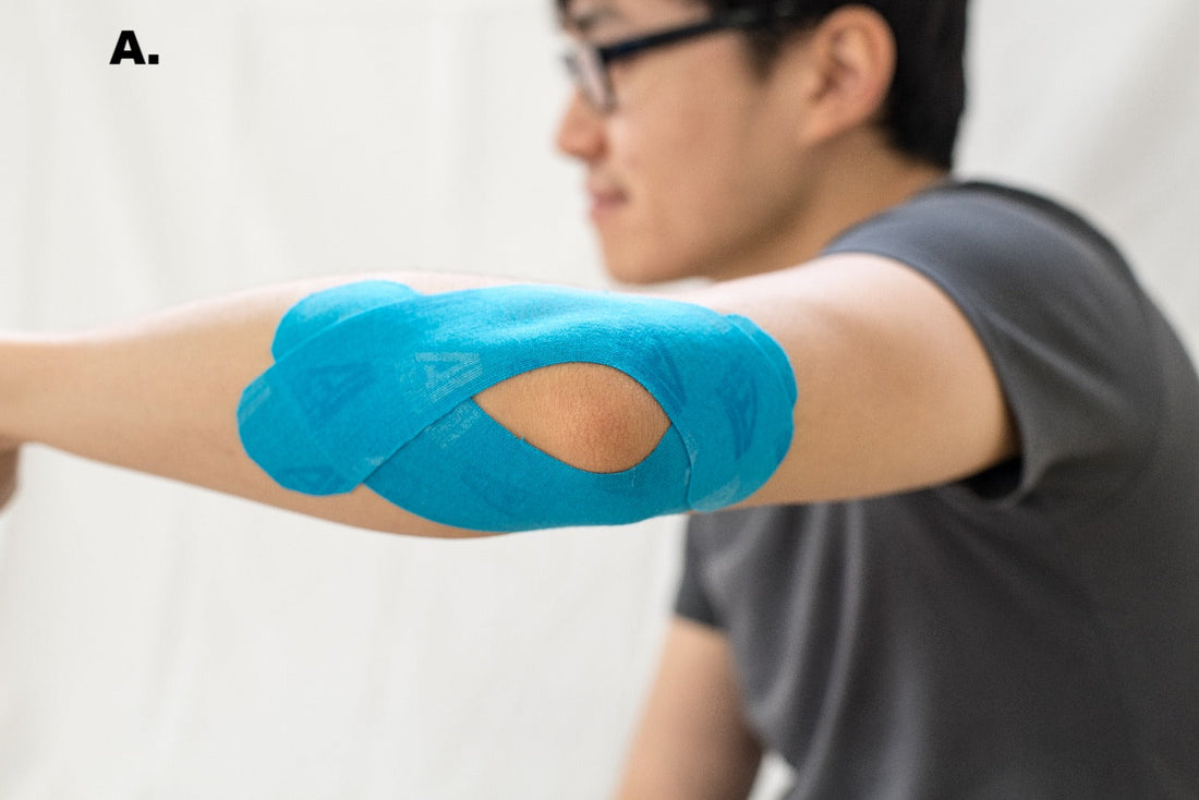 Tennis Elbow & AI Kinesiology Tape